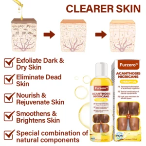 Alternative view of FurzeroTM Acanthosis Nigricans Peeling Oil