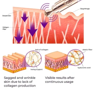 GFOUKTM️ Milk Spots Therapy Electric Serum Pen