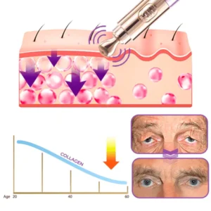 GFOUKTM️ Milk Spots Therapy Electric Serum Pen