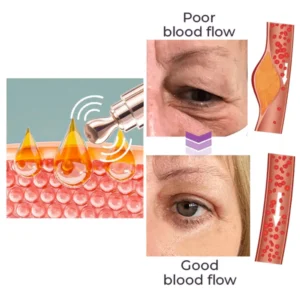 GFOUKTM️ Milk Spots Therapy Electric Serum Pen