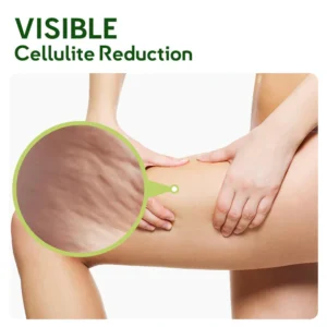 Alternative view of GFOUK MugwortsLegs Cellulite Reduction Patches