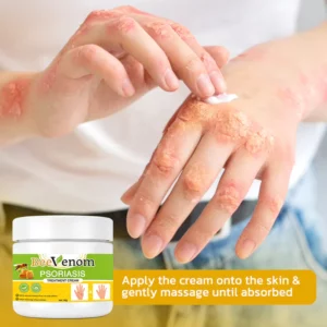 Alternative view of GFOUK™️ BeeVenom Psoriasis Treatment Cream
