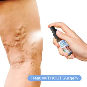 Alternative view of HealthX™ Varicose Veins Spray