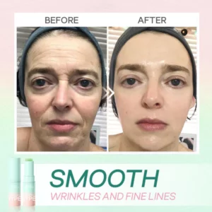 Alternative view of Hyperlift™ Wrinkle Fix Balm