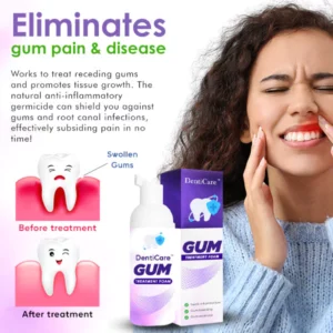 Alternative view of KK™ Gum Treatment Foam