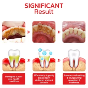 Alternative view of KK™️ SP4 Probiotic Whitening Toothpaste