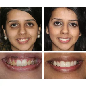 LANTHOME™ Dents Blanchiment Essence