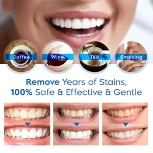 LANTHOME™ Dents Blanchiment Essence