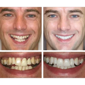 LANTHOME™ Dents Blanchiment Essence