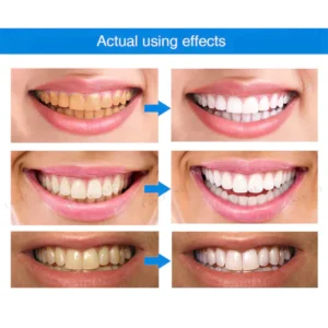 LANTHOME™ Dents Blanchiment Essence