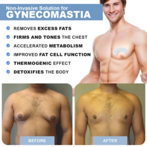 Luhaka™ GynoPatch - Advanced Gynecomastia Reduction Patch