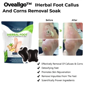 Oveallgo™ IHerbal Foot Callus And Corns Removal Soak