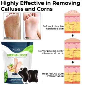 Oveallgo™ IHerbal Foot Callus And Corns Removal Soak