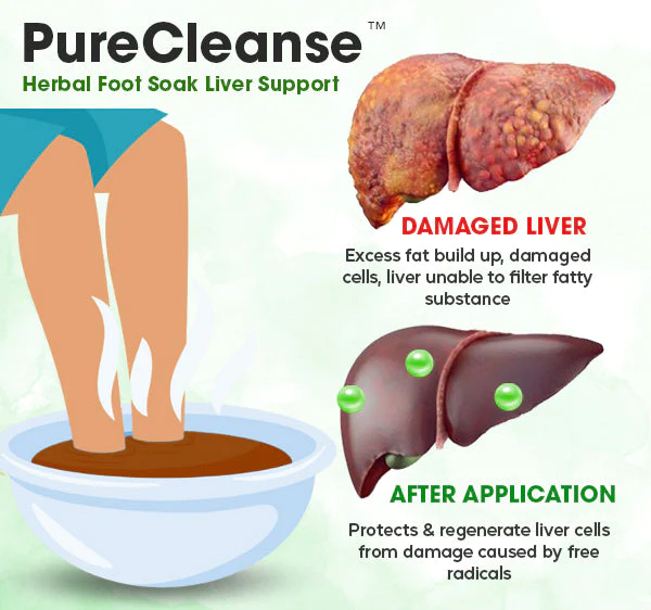 PureCleanse™ Herbal Foot Soak Liver Support