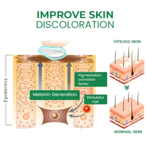 Rodrigo™ VitiligoFix Revitalize Elixir