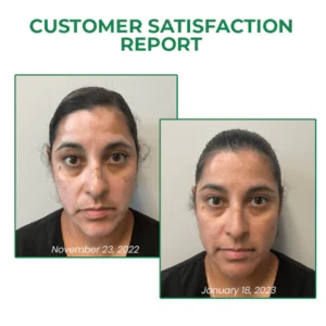 Rodrigo™ VitiligoFix Revitalize Elixir