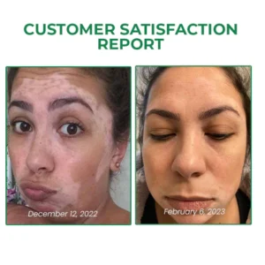 Rodrigo™ VitiligoFix Revitalize Elixir