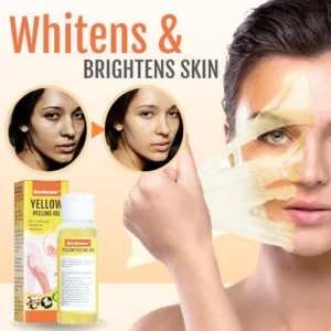 Alternative view of SkinRenew™ Yellow Peeling Oil