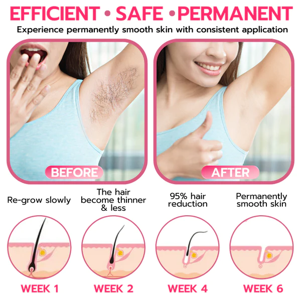 Softee™ Beeswax Hair Removal Mousse - Image 3