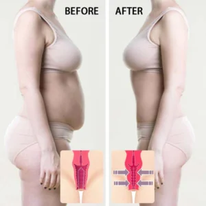 TrimaID™ Anti-Itch & Anti-Odor Detox Slimming Capsule