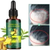 VitiLock 7 Days Herbal Hair Growth Serum