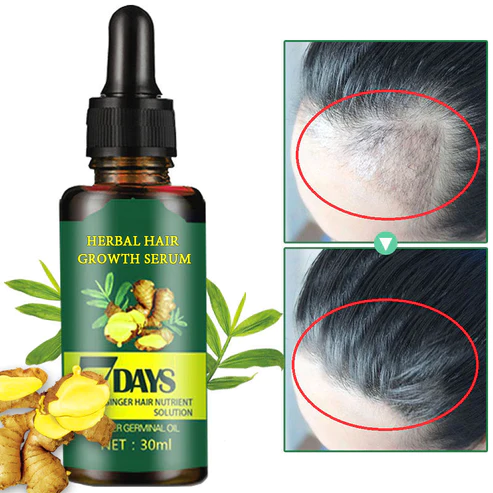 VitiLock 7 Days Herbal Hair Growth Serum