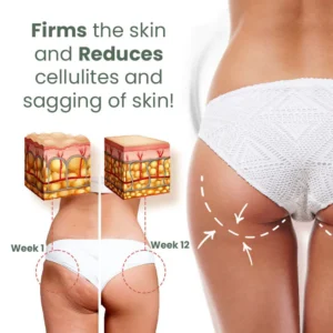 Seurico™ Wormwood CelluliteBeGone Skin Tighten Cream