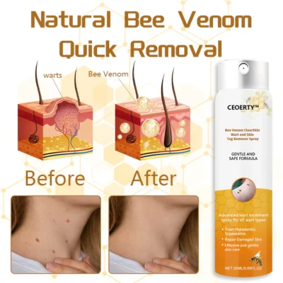 Ceoerty™ Bee Venom ClearSkin Wart and Skin Tag Remover Spray