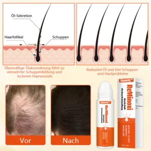 Ceoerty™ ReMinoxi-Biotin Roll-On Haarkur