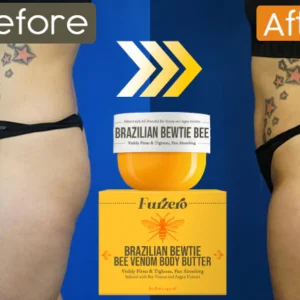 FLYCARE™ Brazilian Bewtie Bee Venom Body Butter