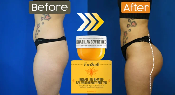 FLYCARE™ Brazilian Bewtie Bee Venom Body Butter