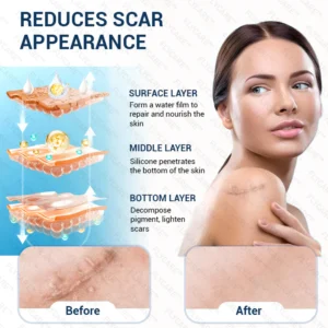 FLYCARE™ Silicone Scar Gel
