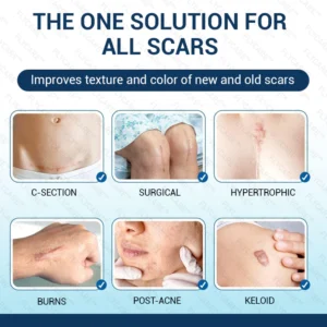FLYCARE™ Silicone Scar Gel