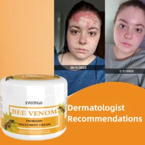 Fivfivgo™ BeeVenom Psoriasis Solution Cream