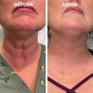 Funsta™ Skin Firming Rejuvenating Serum