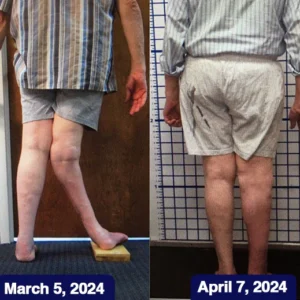 Oveallgo™ Jellyfish Collagen Joint Repair Cream