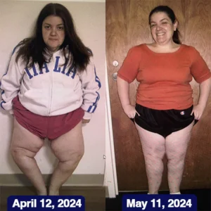 Oveallgo™ Jellyfish Collagen Joint Repair Cream