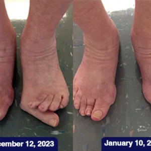 Oveallgo™ Jellyfish Collagen Joint Repair Cream