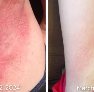 GFOUK™ PomphX Relief Cream