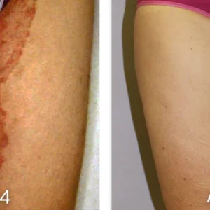 GFOUK™ PomphX Relief Cream