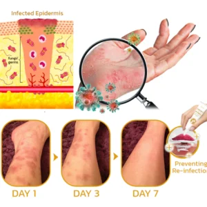 GFOUK™ PomphX Relief Cream