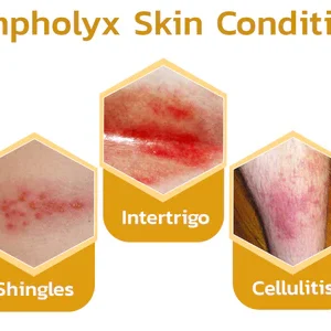 GFOUK™ PomphX Relief Cream