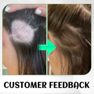 HAIRENEW™ FolliHerb Hair Growth Spray