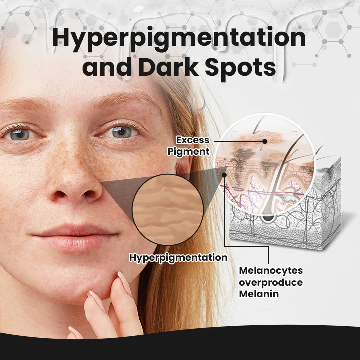 LOVILDS™ BrightEra Melanin Correcting Serum