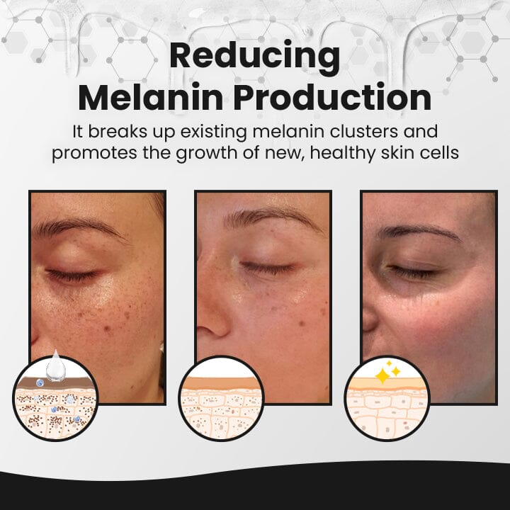 LOVILDS™ BrightEra Melanin Correcting Serum