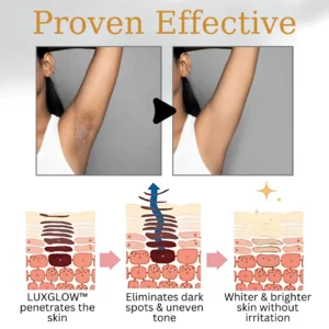 LUXGLOW™ Body Whitening Cream