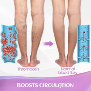 LindoRiva™ Varicose Vein Herbal Treatment Cream