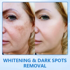Negusy™ LuxeLift B5 Skin Firming Youth Butter
