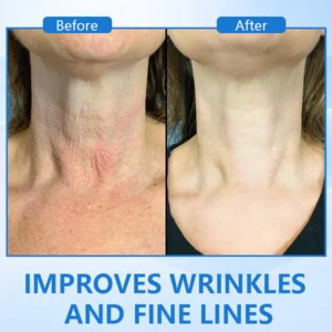 Negusy™ LuxeLift B5 Skin Firming Youth Butter