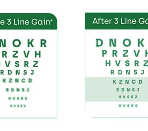 Seurico™ Eye Drops for Presbyopia Rehabilitation